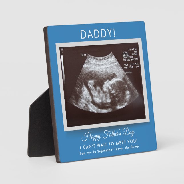 Plaque Photo Annonce de grossesse échographie pour la fête des  (Recto)