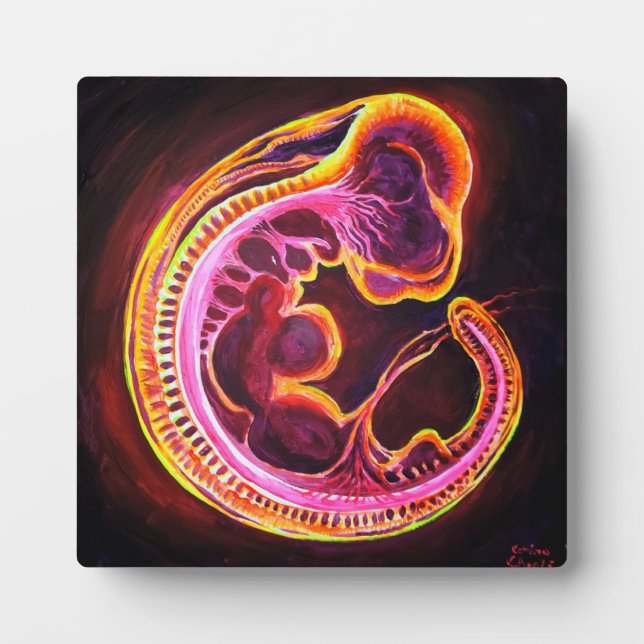 Plaque Photo Embryo (Devant)