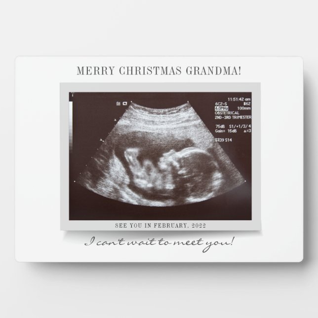 Plaque Photo Joyeux Noël Grand-mère Baby Revey Scan (Devant)