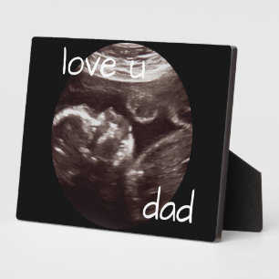 Plaque Photo Ultrasound Photo Love You Papa