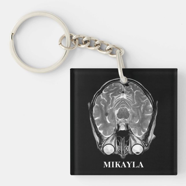 Porte-clefs Porte - clé d'analyse cérébrale IRM personnalisée (Devant)