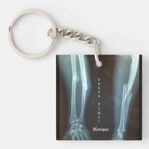 Porte-clefs Rayon cassé et Ulna Xray "Temps de pause"