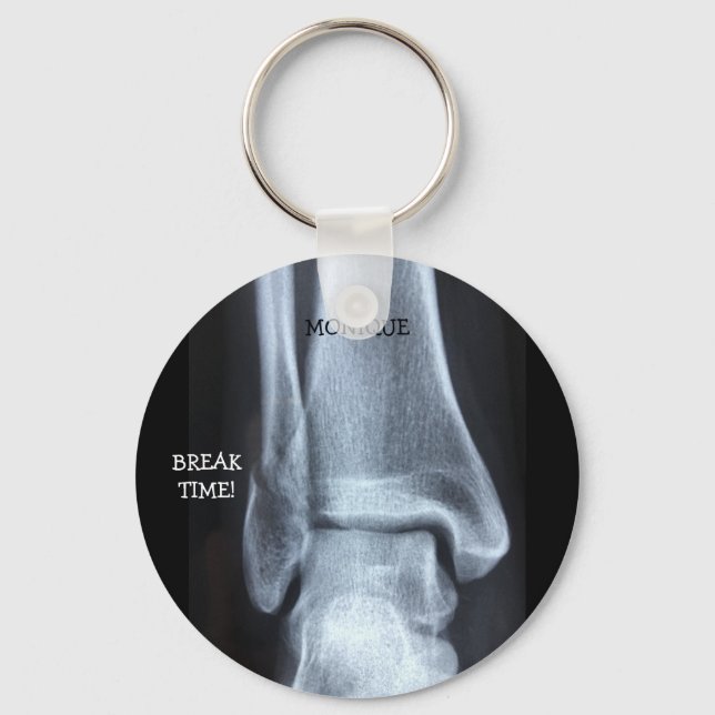 Porte-clés Funny Broken Fibula Xray "Temps de pause" (Recto)
