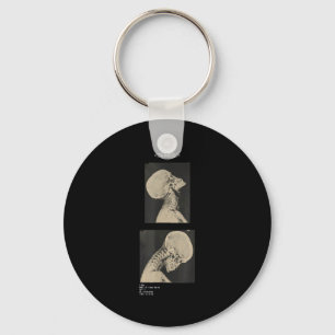 Porte-clés Paramore coupé headbanger radiographie médecins 
