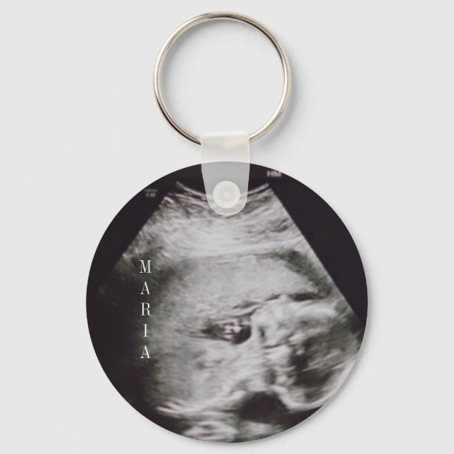 Porte-clés Porte - clé de garde de bébé Ultrasound (Recto)