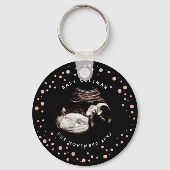 Porte-clés Pregnancy Pink Glitter Sonogram Ultrasound Photo (Recto)