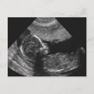 Postale visage de bébé, carte