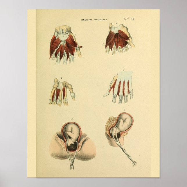 Poster Anatomie des forceps de naissance Anatomie Art Méd (Devant)