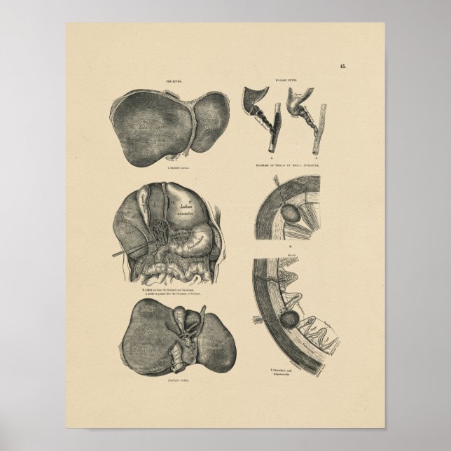 Poster Anatomie vintage du foie 1880 Imprimer (Devant)