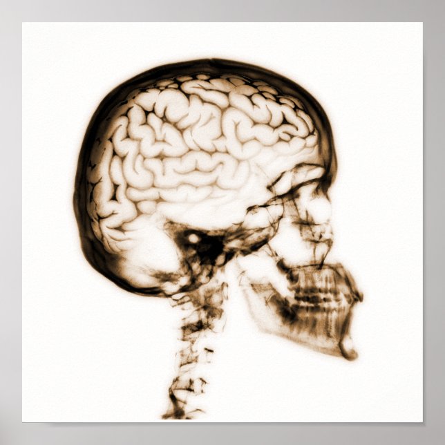 POSTER CERVEAU JUMEAU X-RAY - ORANGE (Devant)