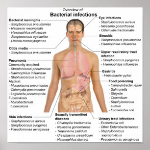 Poster Chart of bacterial infections in Humans 