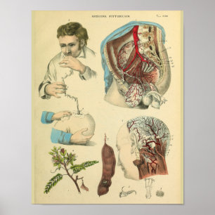 Poster Chirurgie cérébrale Tête Anatomie Art Docteur Impr