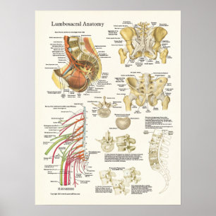 Poster d'anatomie Lumbosacral et dégénérescence de