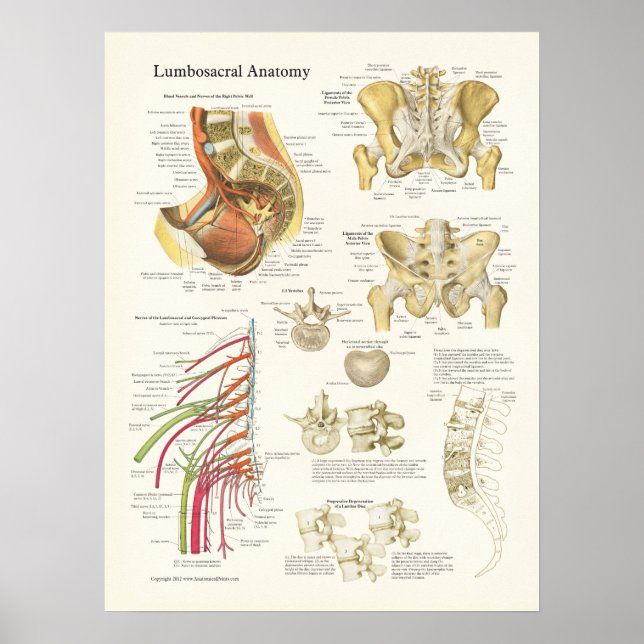 Poster d'anatomie Lumbosacral et dégénérescence de (Devant)