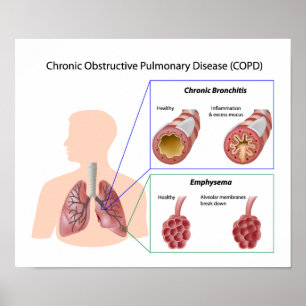 Poster de la maladie pulmonaire (MPOC)