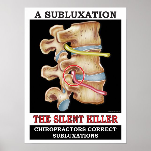 Poster de subbluxation Vertébrale Chiropratique (Devant)