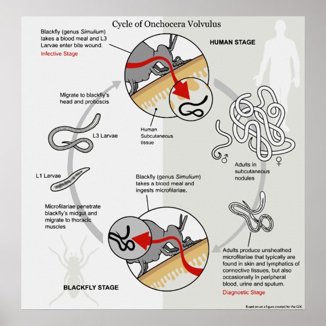 Poster Diagram of The Life Cycle of Onchocerca Volvulus (Devant)