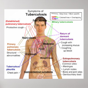 Poster Diagramme de symptôme de la tuberculose chez