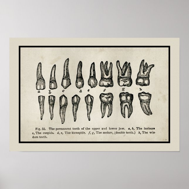 Poster Diagramme des dents inspiré vintage (Devant)