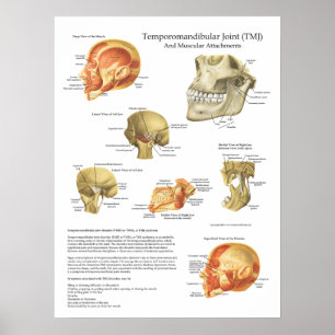 Poster Docteur musculaire de diagramme d'attachements