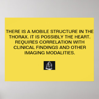 Poster du rapport Echo Cardiac