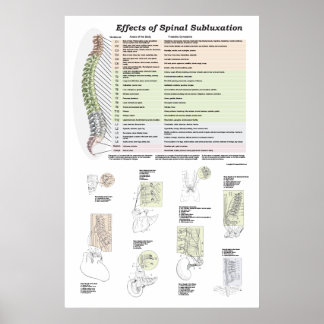 Poster Effets de la subbluxation de la colonne vertébrale