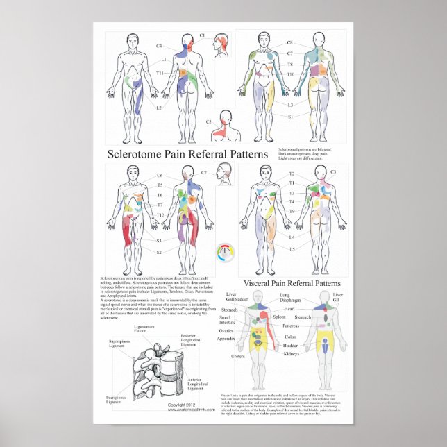 Poster Graphique de référence de la douleur viscérale de  (Devant)