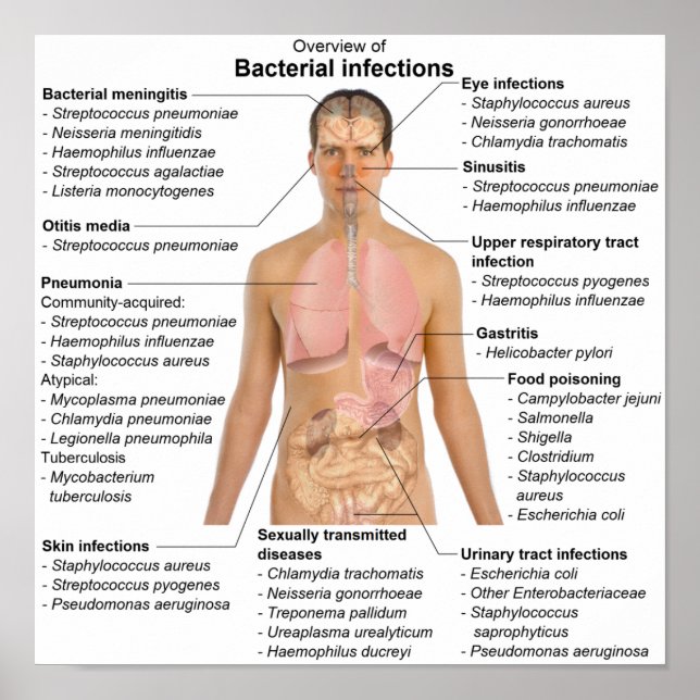 Poster Graphique des infections bactériennes chez  (Devant)