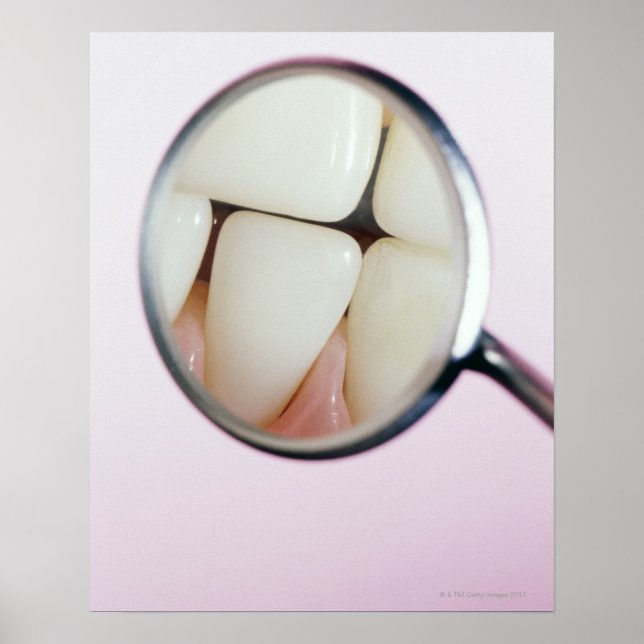 Poster Gros plan des dents reflété dans le miroir dentair (Devant)