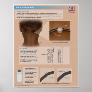 Poster Médicale de la rupture des cheveux de la mé