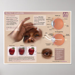 Poster Médicale de protection des yeux de mélalogi