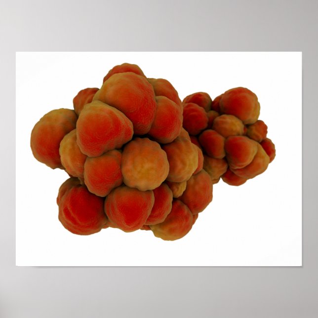 Poster Microscopic View Of Tumor 4 (Devant)