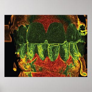 Poster Orthodontiste Dentiste