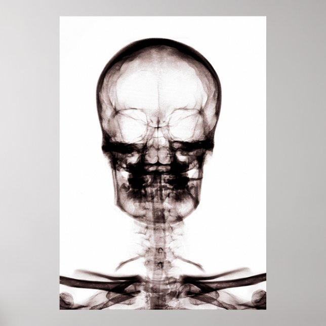 POSTER POSTER/IMPRIMER X RAY VISION SKELETON SKULL ORIG/N (Devant)