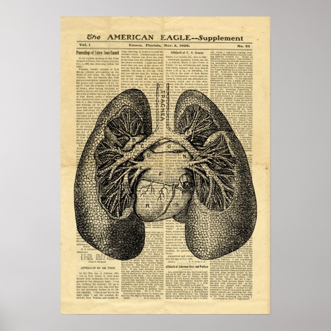 Poster poumons humains Antique Anatomie sur le jou (Devant)