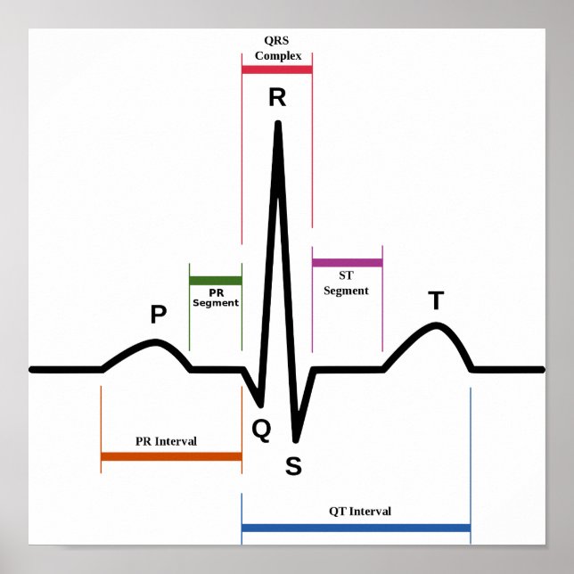 Poster Sinus rythm Electrocardiogramme ECG Diagram (Devant)