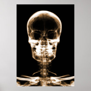 POSTER SKELETON DE VISION X-RAY SKULL - ORANGE