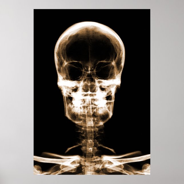 POSTER SKELETON DE VISION X-RAY SKULL - ORANGE (Devant)