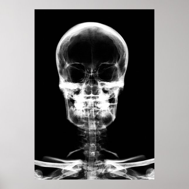 POSTER SKELETON VISION X-RAY SKULL - B&W (Devant)