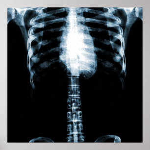 POSTER SKELETON X-RAY TORSO RIBS - BLEU