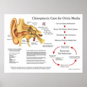 Poster Soin de chiropractie pour des infections d'oreille