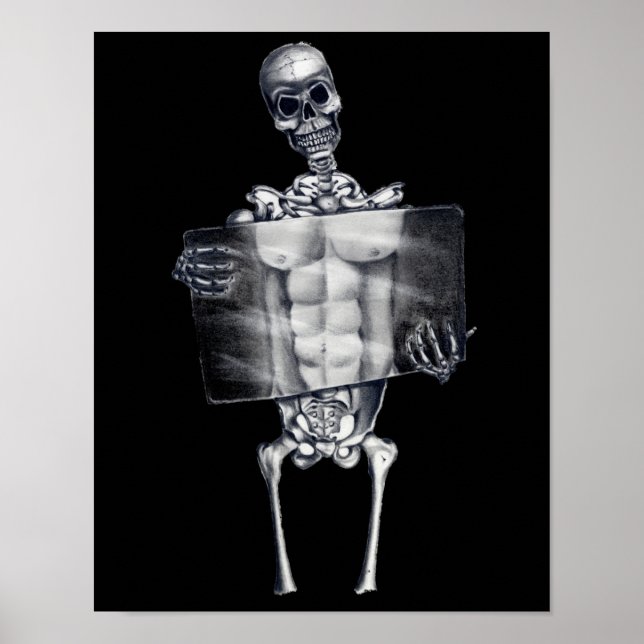 Poster squelette poitrine Xray (Devant)
