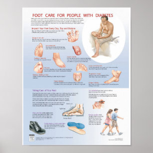Poster sur les soins du pied du diabète - Carte ré