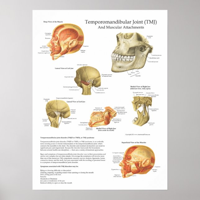 Poster TMJ Anatomie Attachements musculaires Graphique Do (Devant)