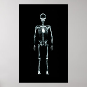 Poster - X-Ray Vision Single Skeleton Original