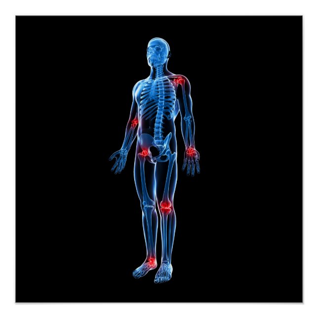 Poster Xray humain (Devant)