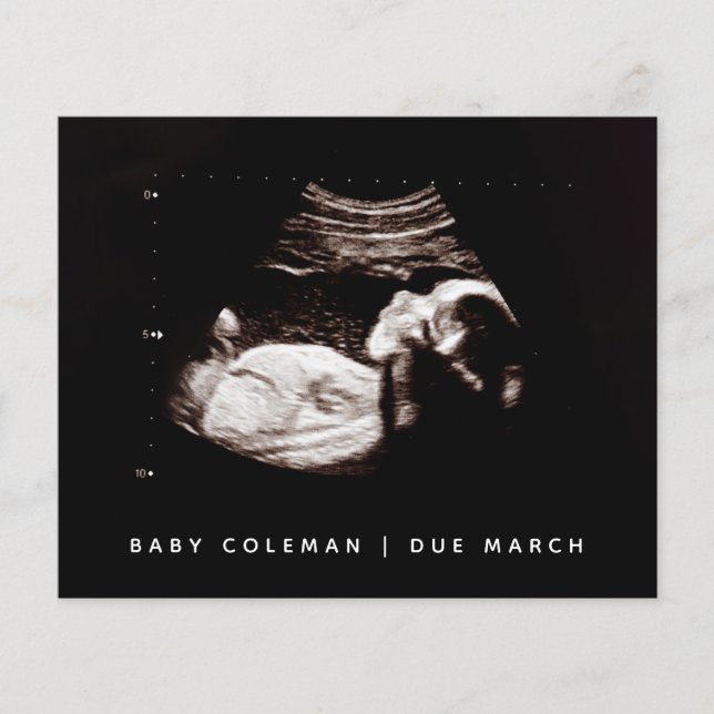 Prospectus 11,4 Cm X 14,2 Cm Budget Grossesse Bébé Sonogramme Ultrasons Photo (Devant)