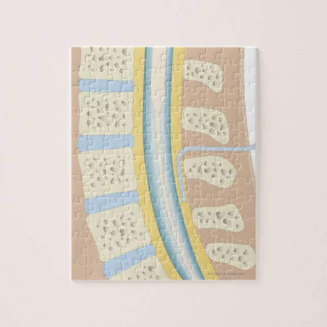 Puzzle Anesthésie épidurale (Vertical)