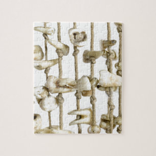 Puzzle Dentiste de dents extrait par photographie
