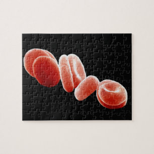 Puzzle Globules rouges